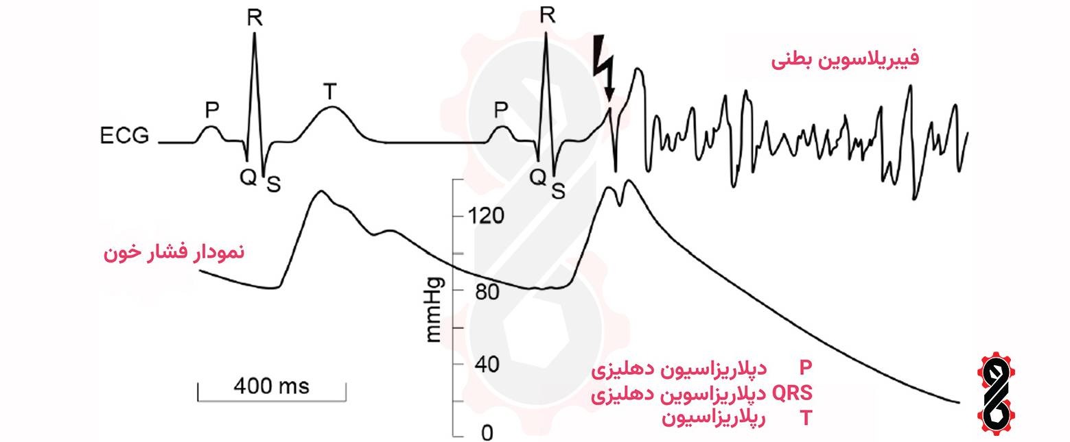 اثر برق گرفتگی بر بدن انسان 6 دترین زمان برای وقوع برقگرفتگی برای قلب انسان در حین استراحت دهلیزها